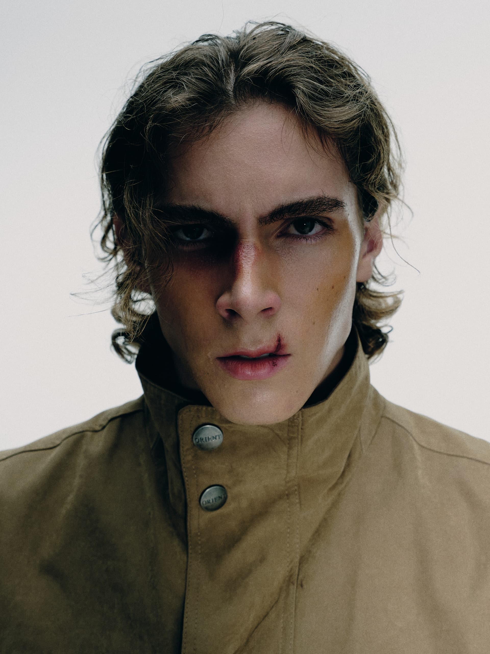 A person in a tan coat with a serious expression and light facial bruising.